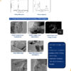 Graphene Nano Platelets (GNP)
